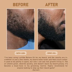 Qilman™ LuxVibe Batana Oil Beard Growth